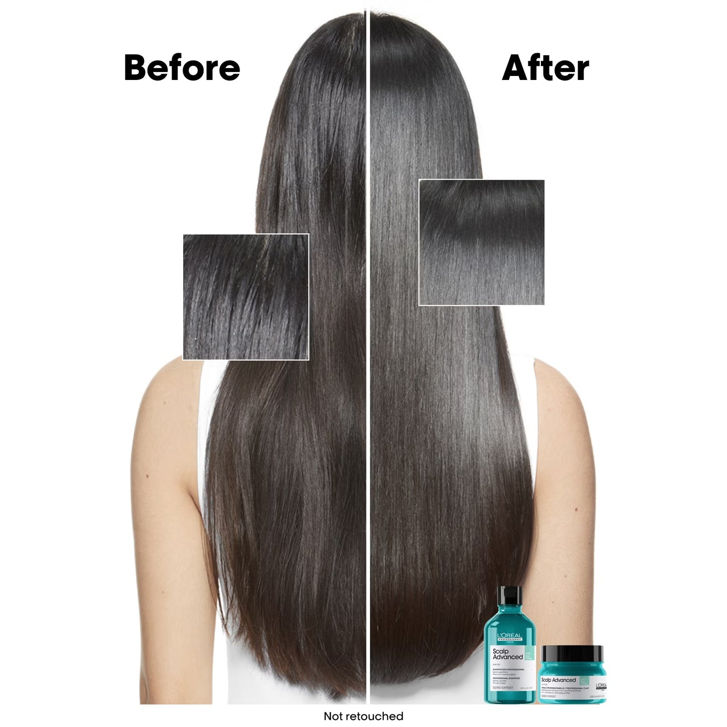 L'Oréal Professionnel Scalp Advanced Shampoo Anti-Grasa